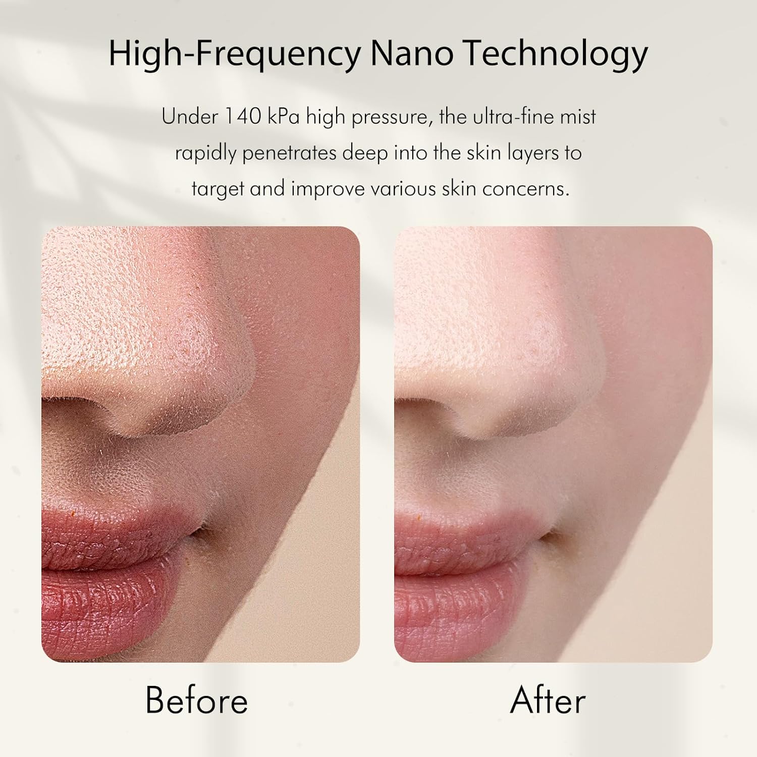Нано-ионный распылитель холодн – обзор и цена Face Steamer